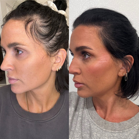 Hair Growth Serum